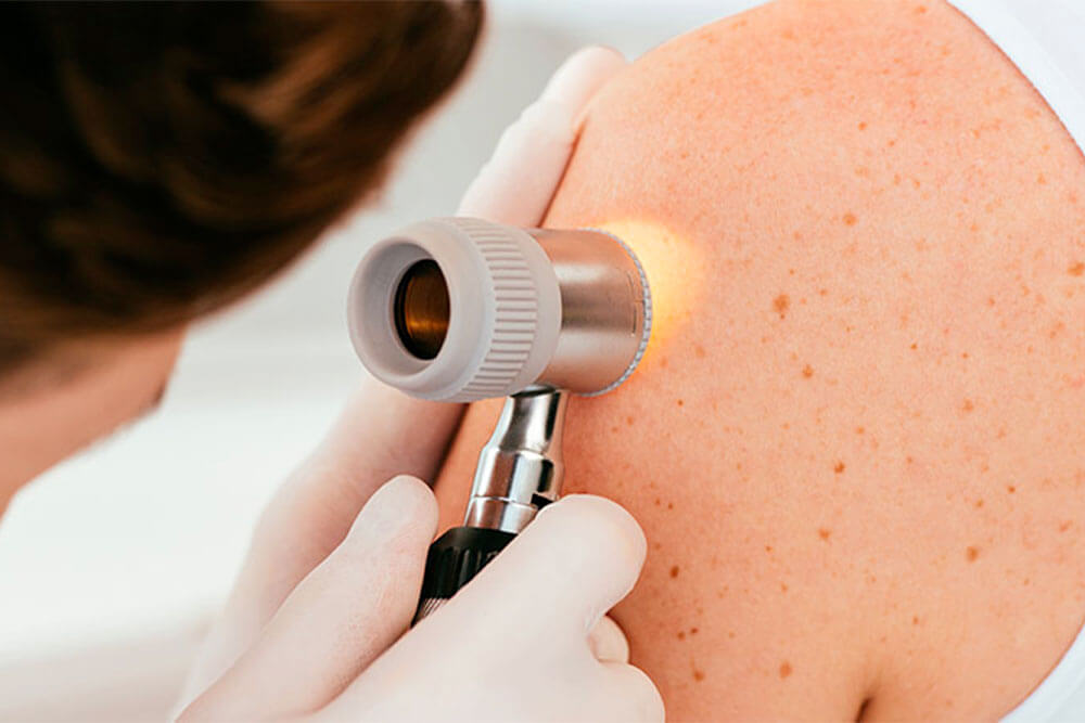 Échographie dermatologie