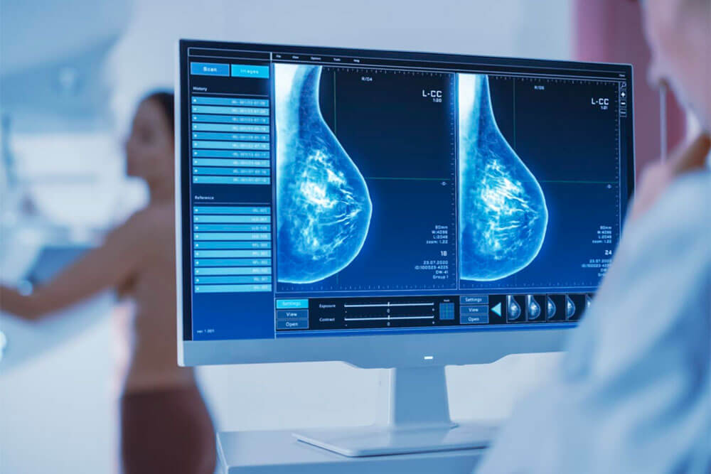 Échographie radiologie