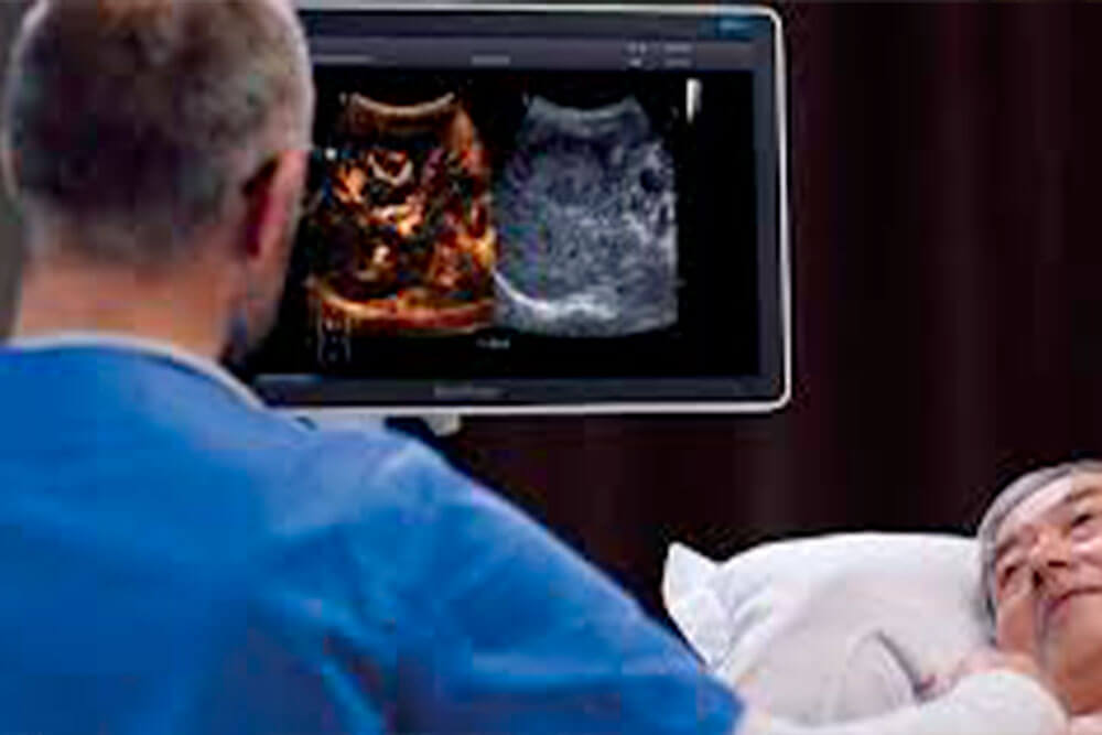 échographe Sonoscape médecine générale