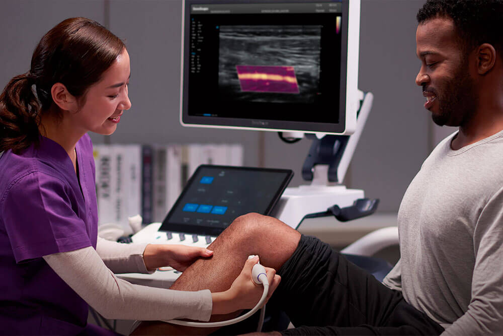 échographe Sonoscape rhumatologie